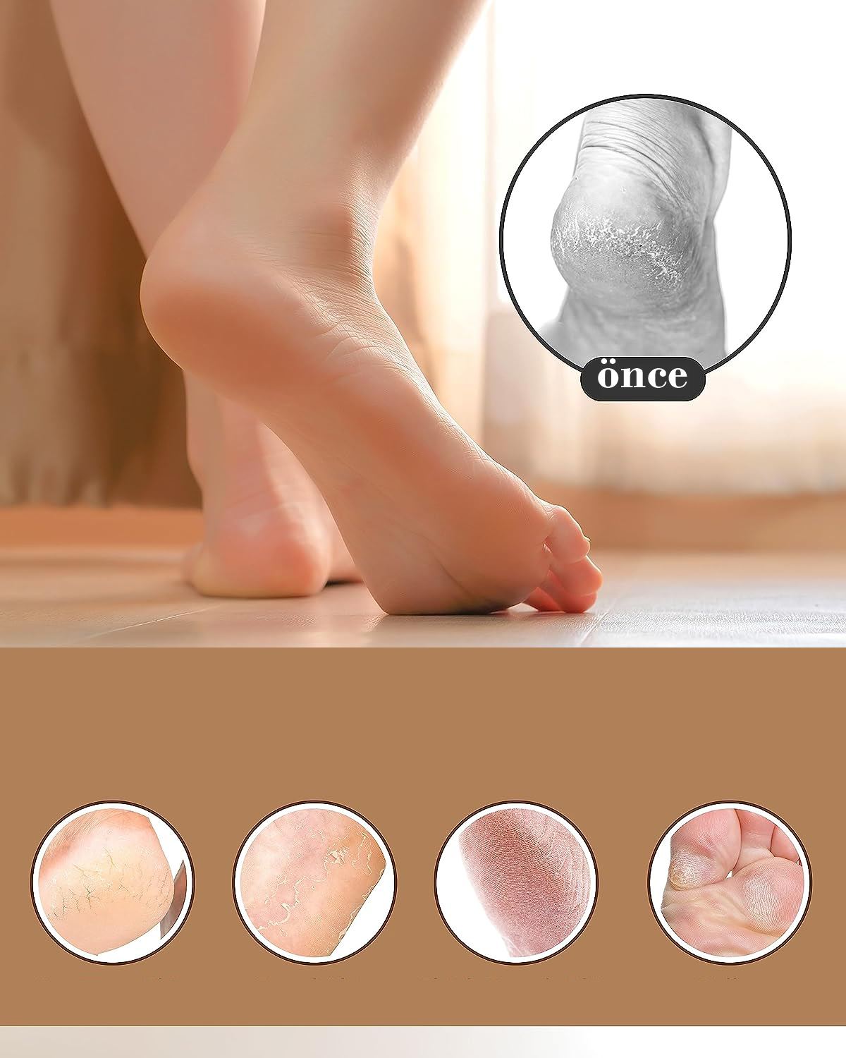 TransForMacion Topuk Törpüsü 2li Set Solingen Professional 719258