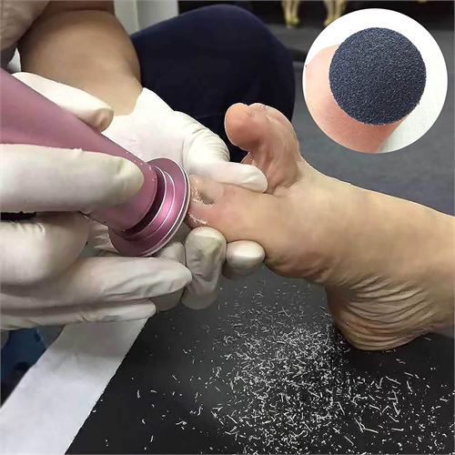 TransForMacion Nasır Sökücü Yedek Pedler Makine İçin 100 ADET 720484