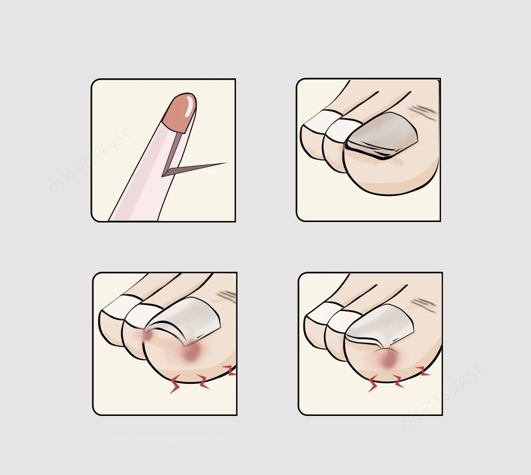 TransForMacion Süper İnce Tırnak Makası Bileylenebilir Solingen 720498