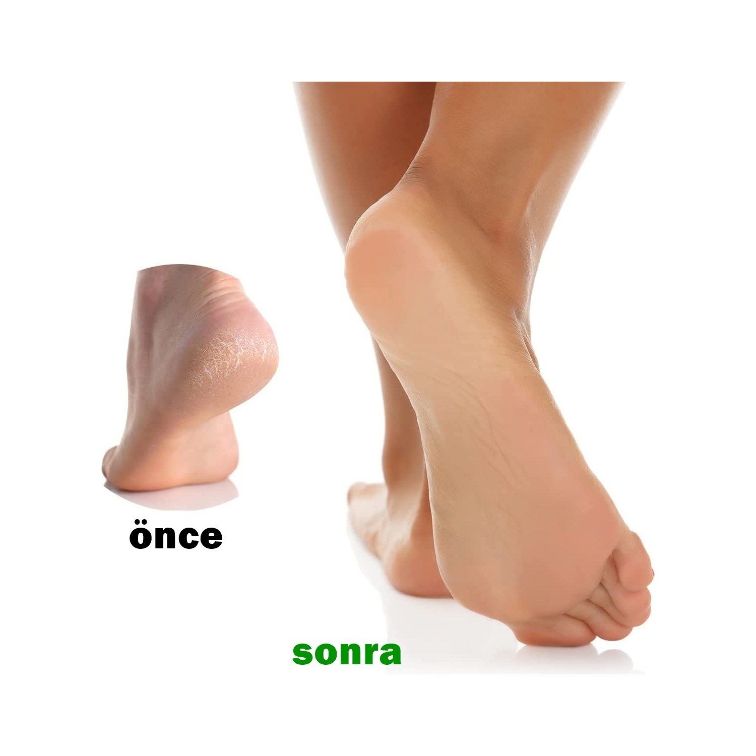 TransForMacion Peeling Topuk Törpüsü 2 Taraflı Solingen Professional 720646