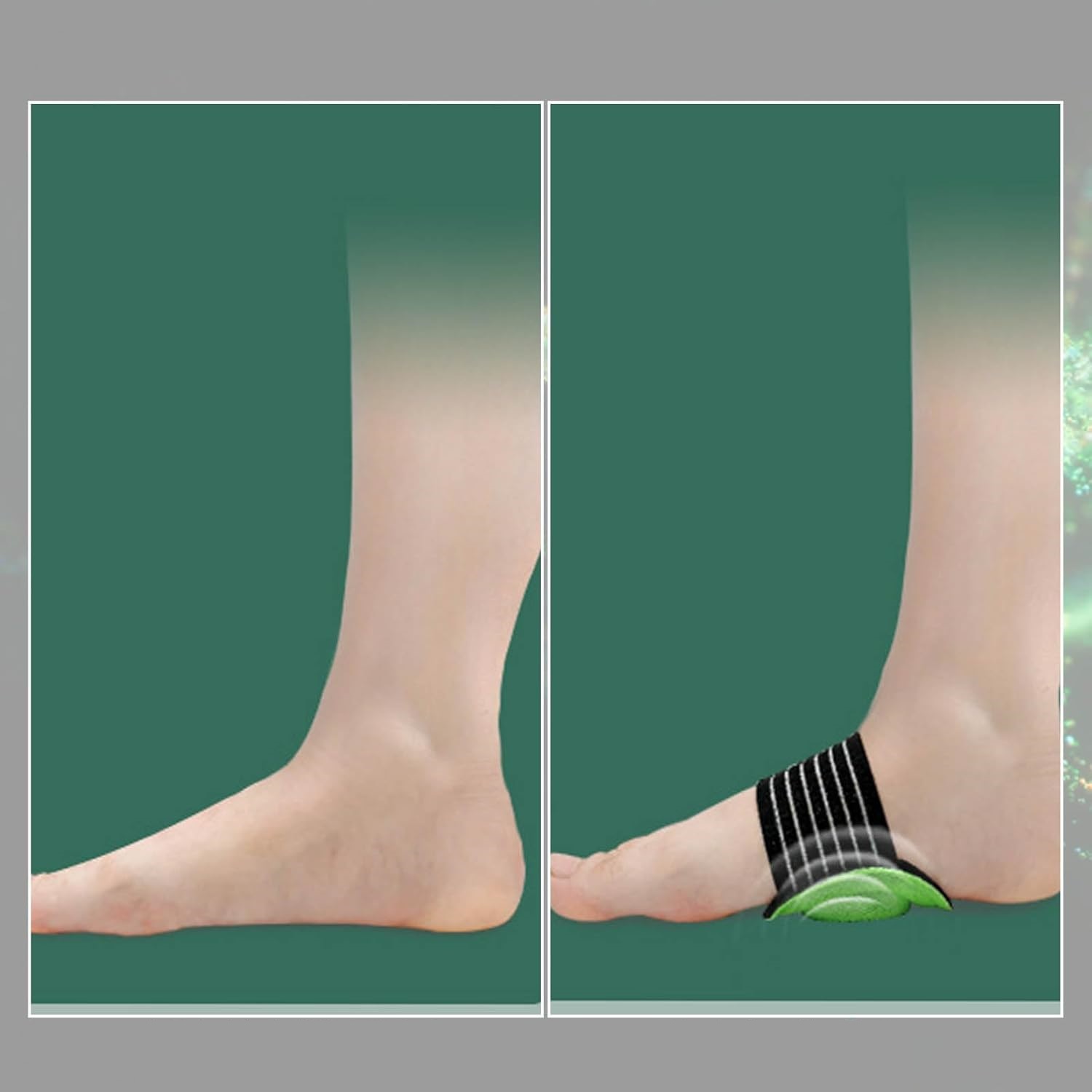 TransForMacion Ayak Boşluğu Desteği Esnek Yumuşak Ayak Rahatlatıcı  720811