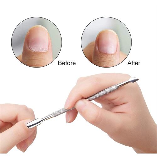 TransForMacion Tırnak Et İtici Kronk Seti Tırnak Temizleyici Et İtici Solingen 720882