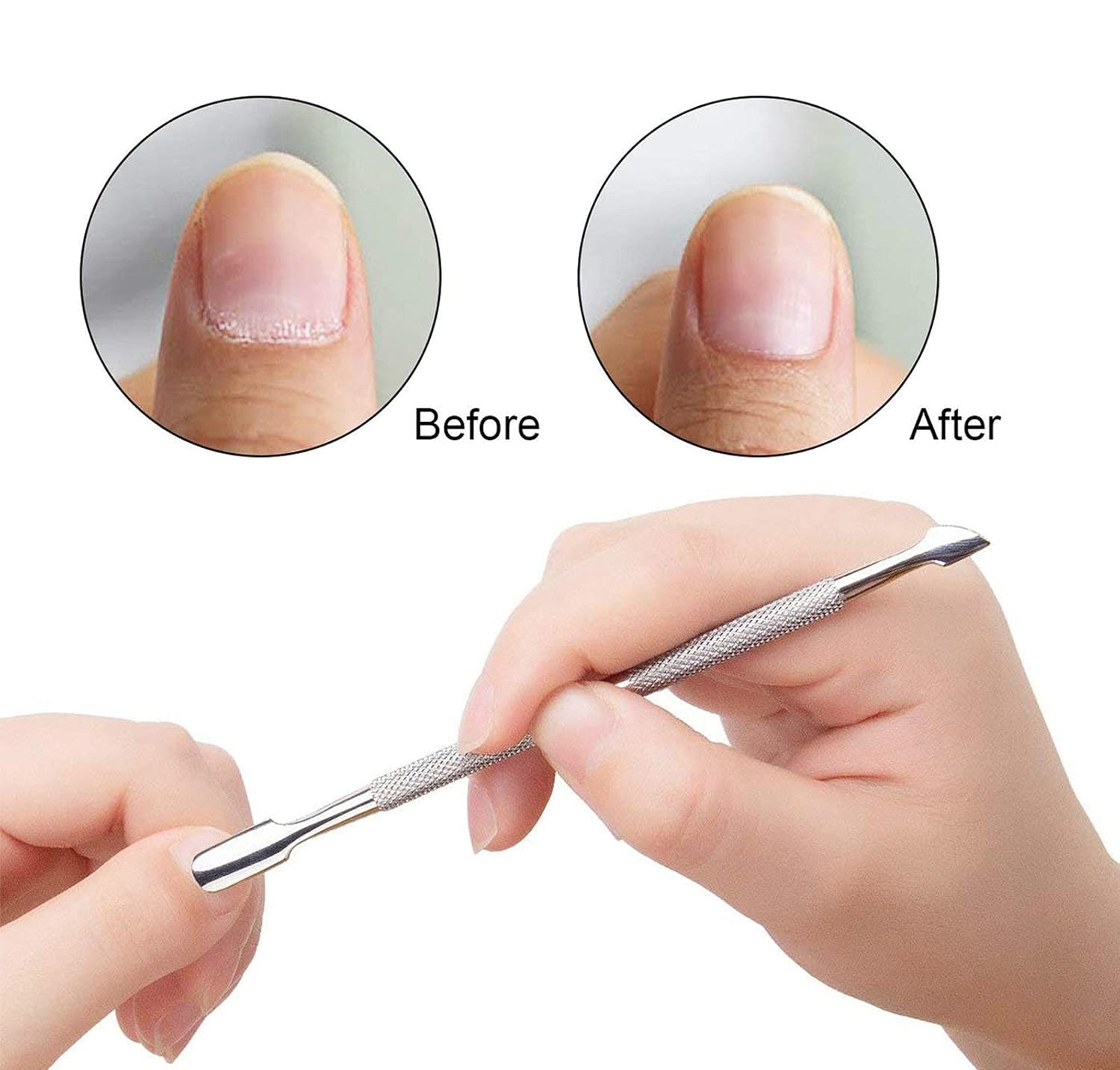 Tırnak Et İtici Kronk Seti Tırnak Temizleyici Et İtici Solingen 720882