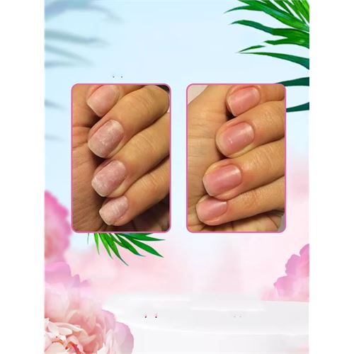 TransForMacion 4 Yüzeyli Tırnak Törpüsü ve Parlatma Blok Sünger Solingen Professional 716803  