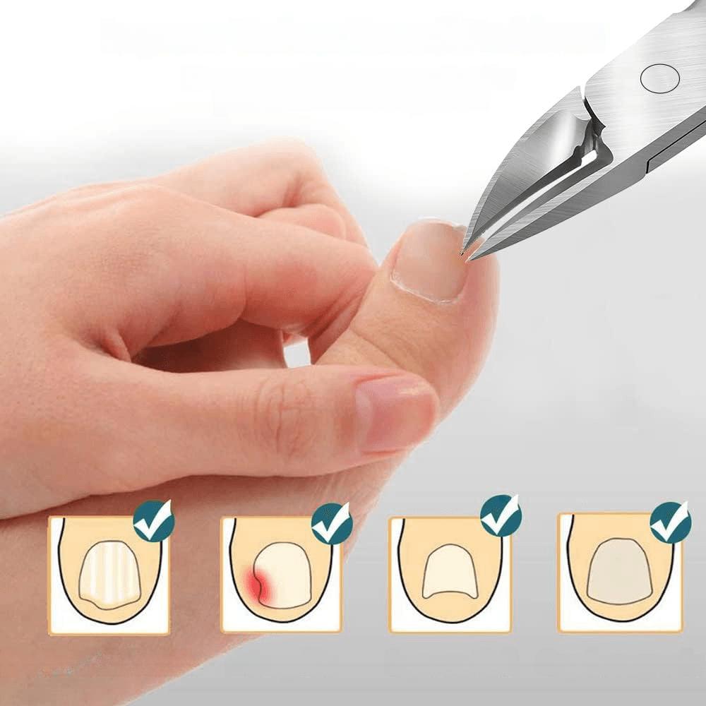 TransForMacion Tırnak Batık Makası Pedikür Makası Tungsten Çelik Profesyonel 721218