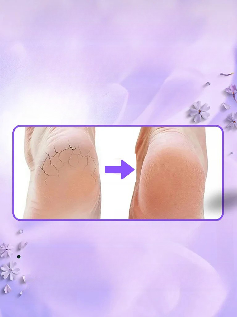 Ayak Bakım Çorabı Silikon Ayak Krem Uygulama Koruyucu Çorap 721585