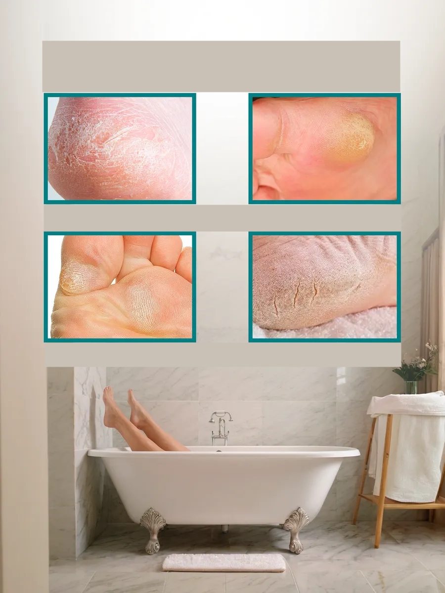  Çelik Topuk Törpüsü - 10 Yedekli Profesyonel Çelik Topuk Törpüsü Solingen Professional 721909	