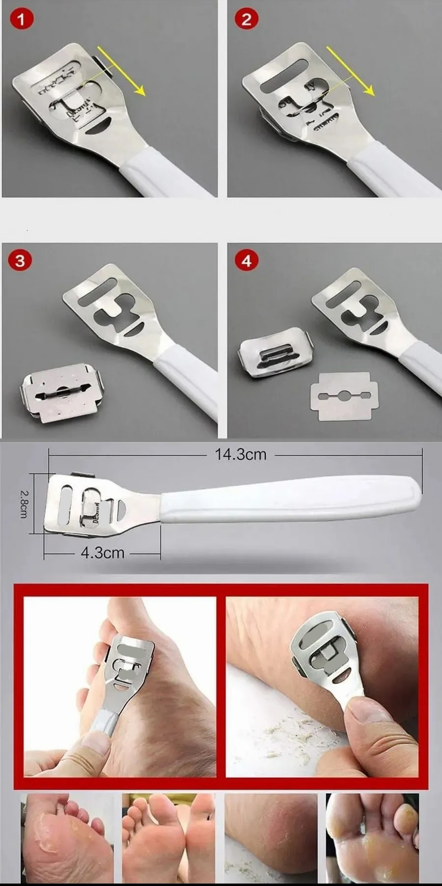 Raspa Aleti - Jiletli Ayak Topuk Törpüsü 2 adet Solingen Profesyonel 721900