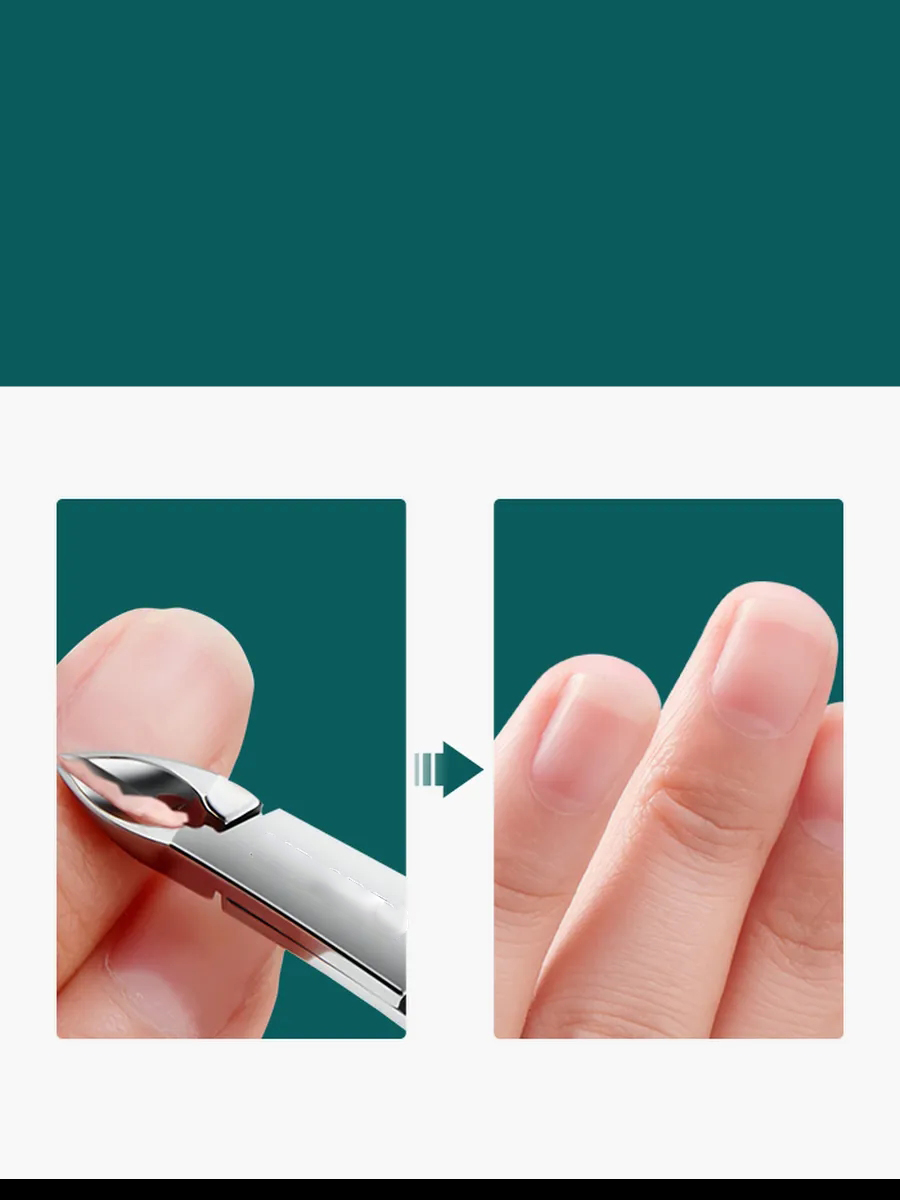 5 mm Manikür Pedikür Makası - Et Makası - Kütikül Temizleyici Pens Profesyonel Cerrahi Çelik 721927