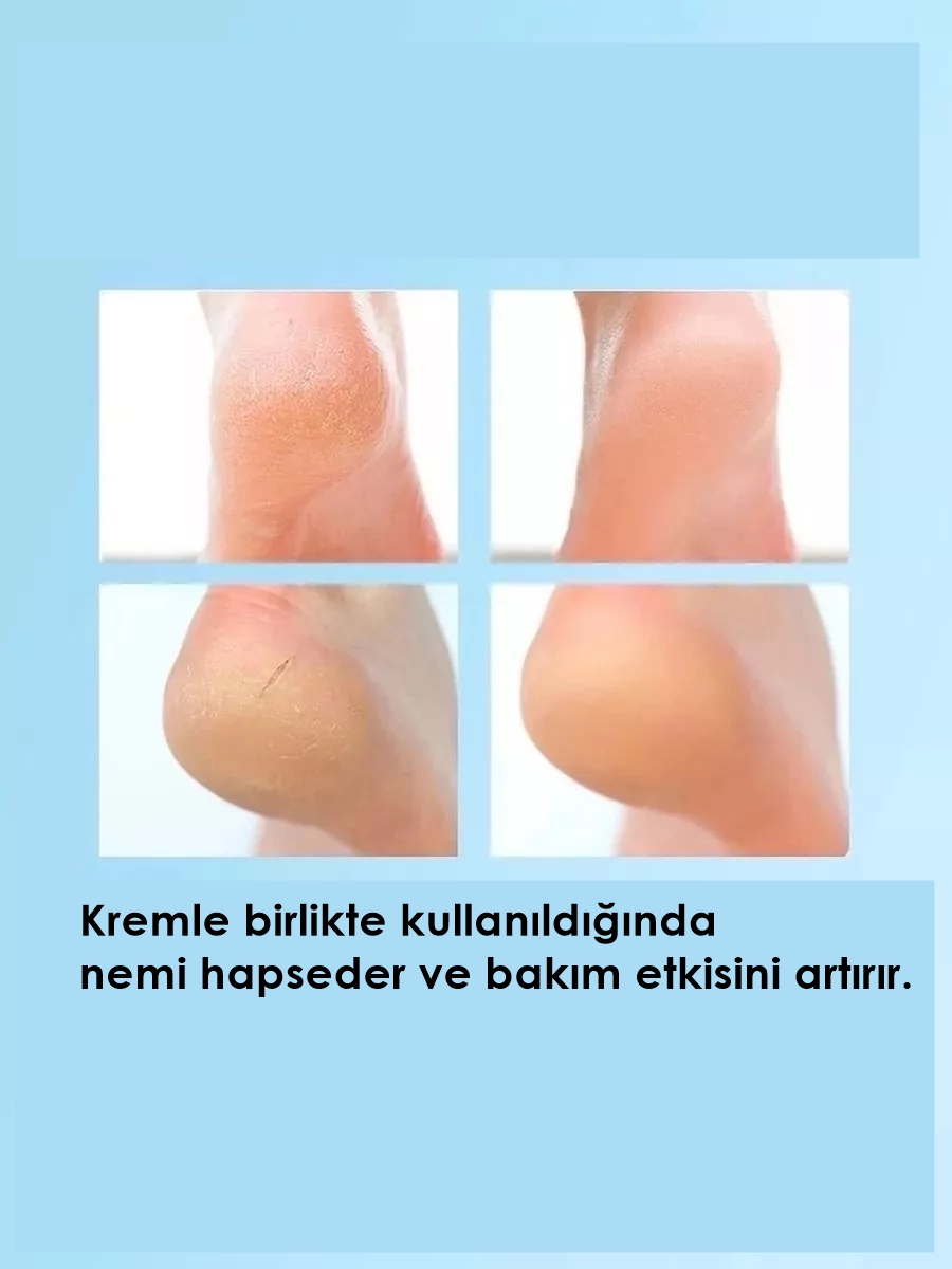 Topuk Çatlak Çorabı - Nem Tutucu Topuk Bakım Çorabı 2 ÇİFT 721955