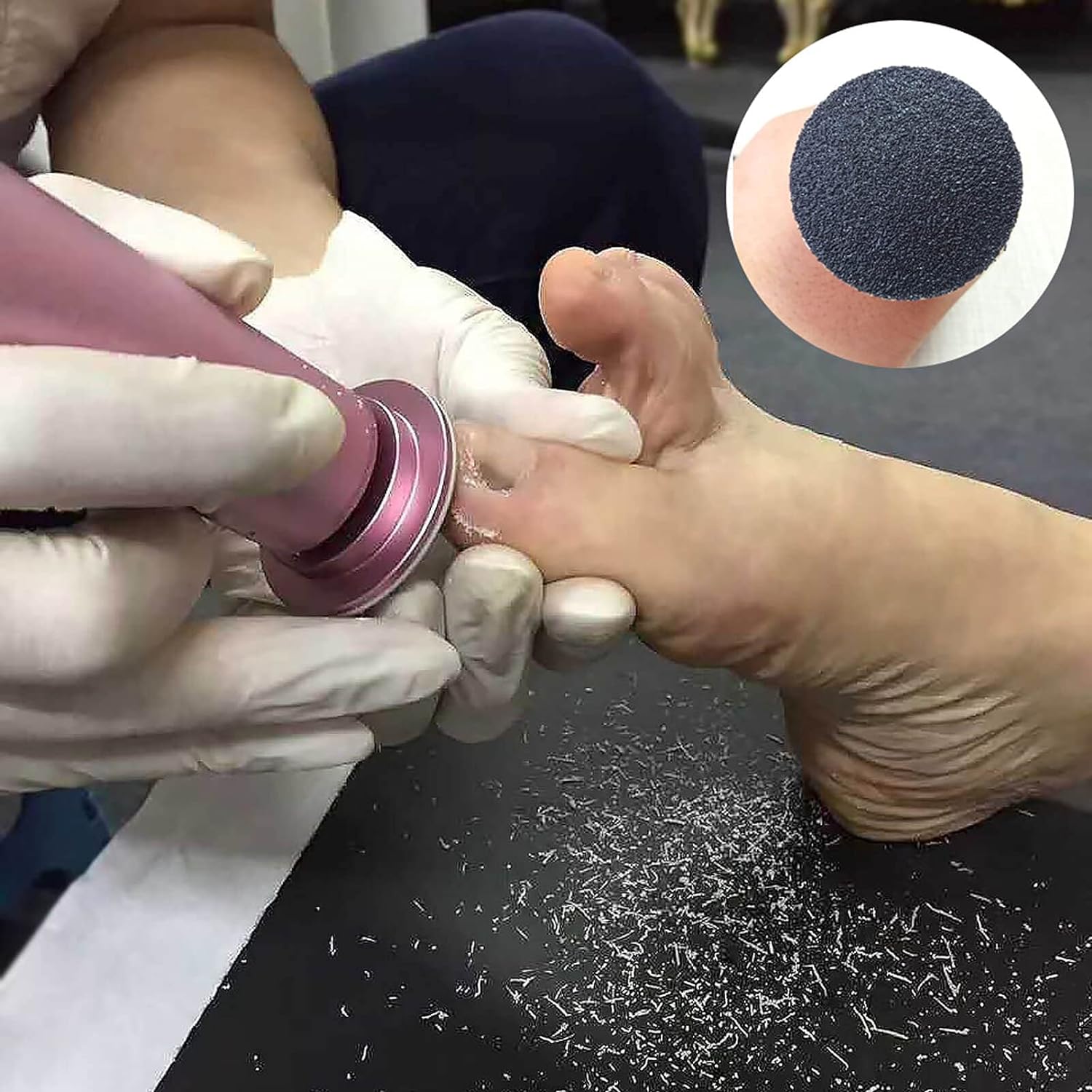 25 mm Pododisk - Nasır Sökücü Pedikür Makinesi Yedek Pedler 100 ADET 722073