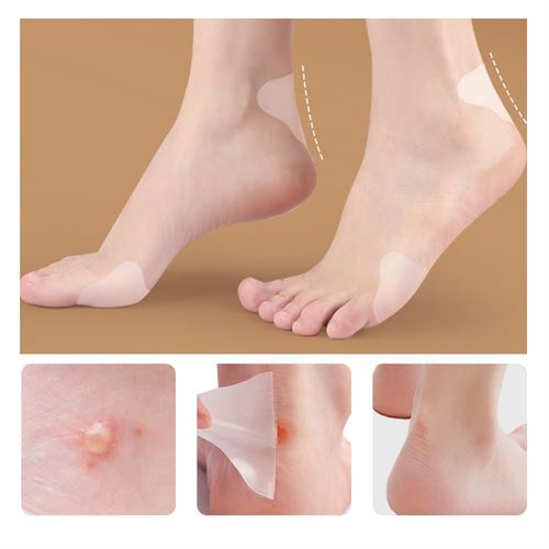 TransForMacion Ayak Vurma Önleyici Bant 20 Lİ PAKET 722136