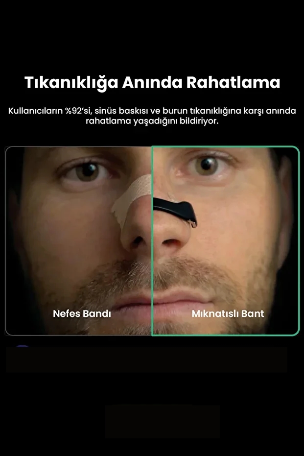 Manyetik Burun Bandı - 30 GÜNLÜK Sporcu Burun Bandı - Horlama Önleyici Azaltıcı - 4 Farklı Boyut 722149