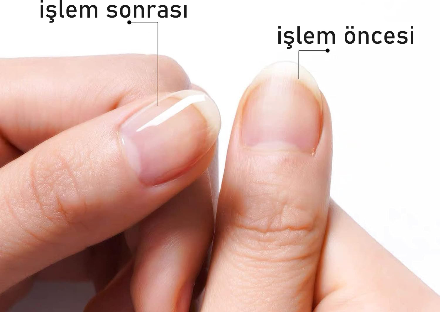 Tırnak Yağı Canladırıcı Bakım Kalemi 2 Li Paket 718771