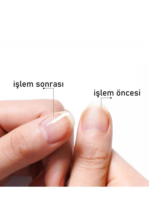 Tırnak Yağı Canladırıcı Bakım Kalemi 2 Li Paket 718771