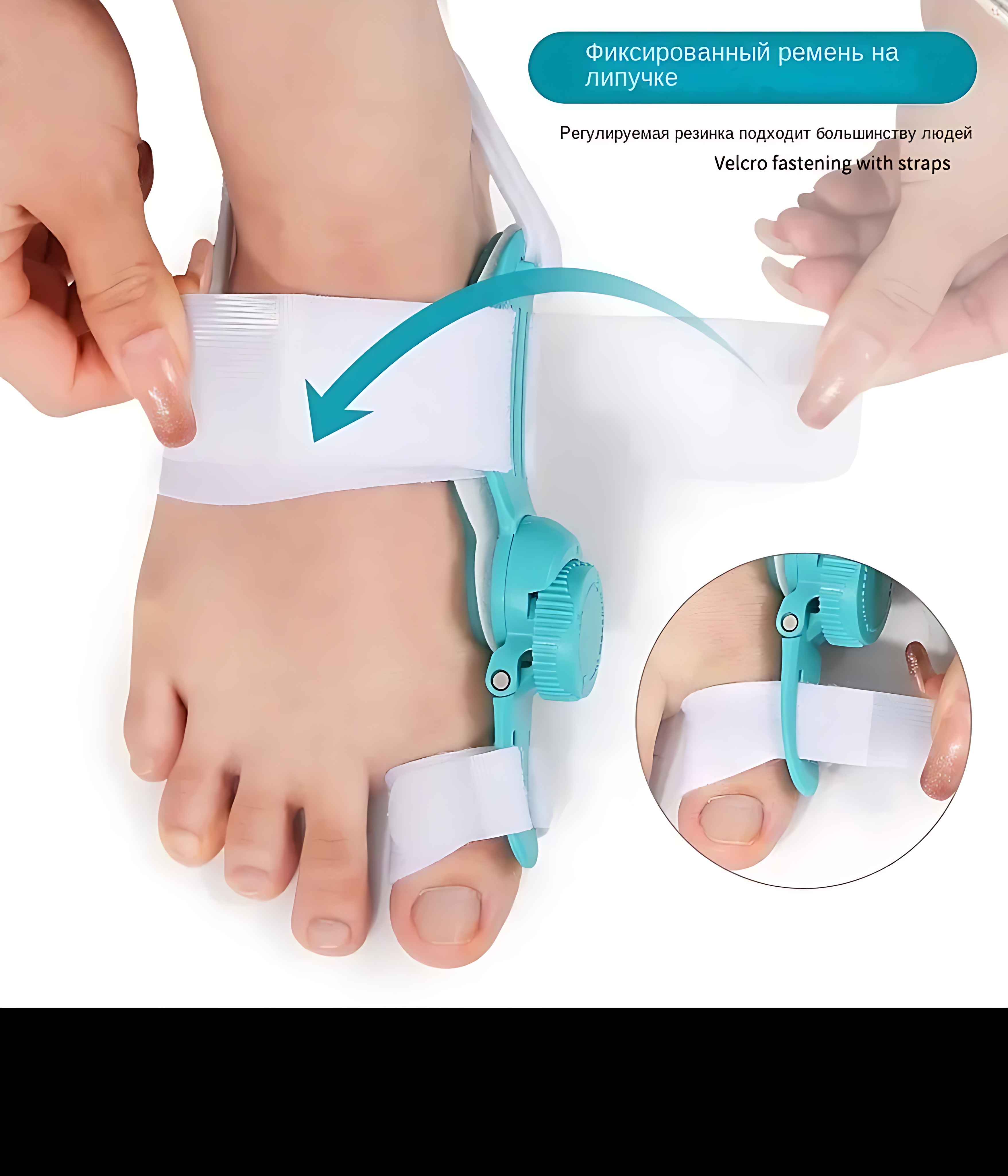 Makaralı Ayarlanabilir Mekanizmalı Bunyo n Düzeltici - Ortopedik Gece ve Gündüz Ateli 722658