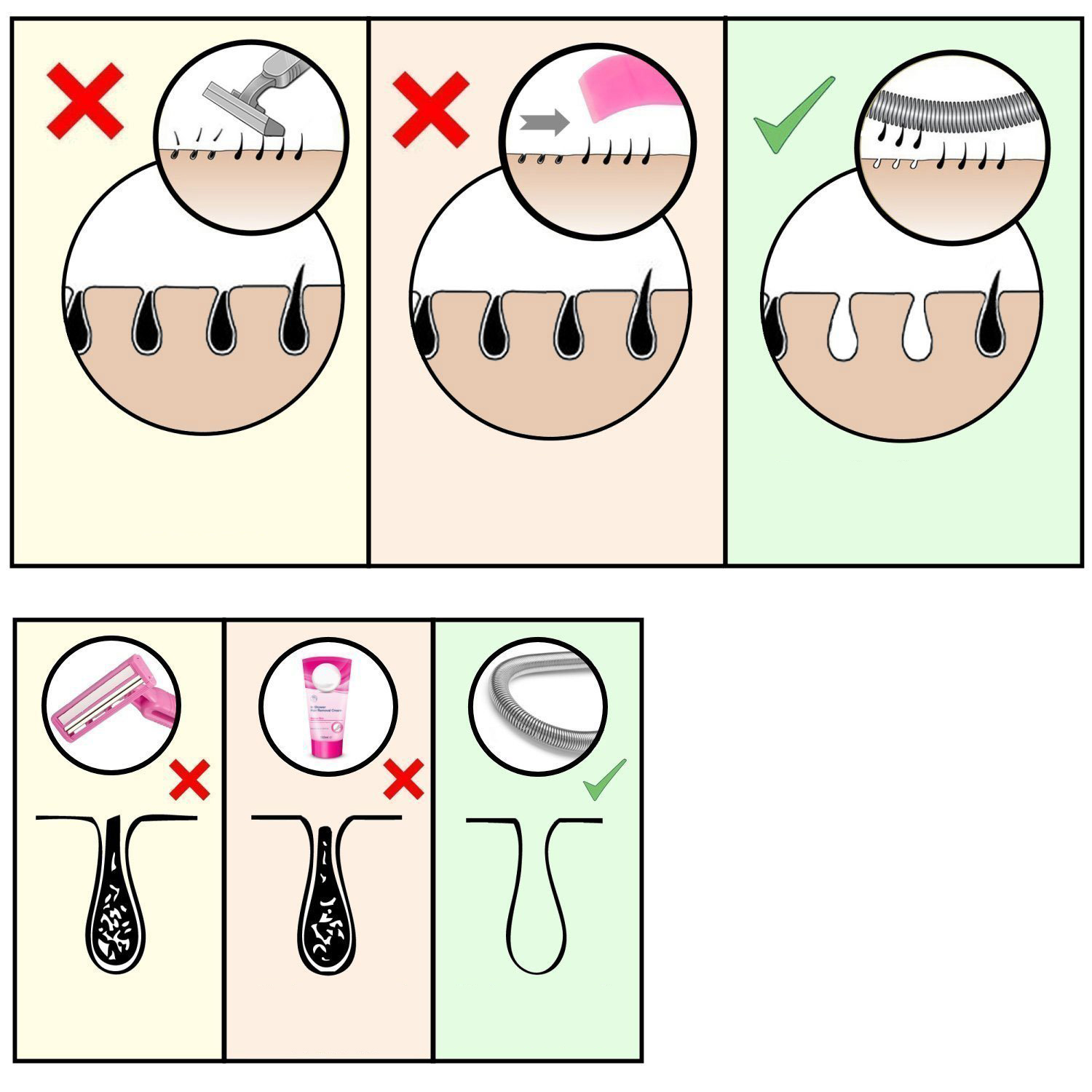 Pürüzsüzlük Sanatı: Profesyonel Çelik Yaylı Yüz Epilatörü – Pratik ve Kusursuz Cilt Bakımı 722769