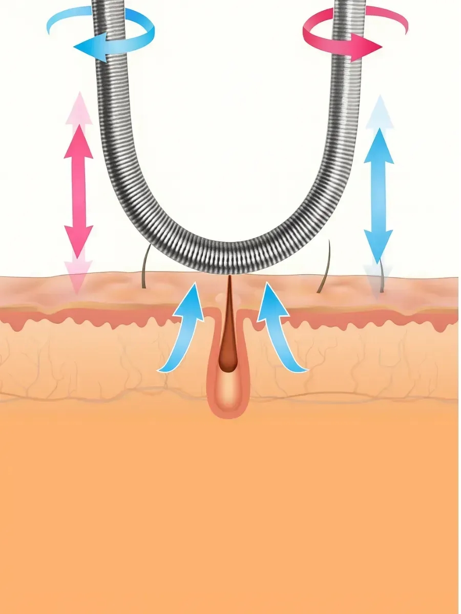Pürüzsüzlük Sanatı: Pratik Yaylı Yüz Epilatörü: İnce Tüylere Kesin Çözüm, Bıyık ve Yüz Tüy Alma Yayı 722770