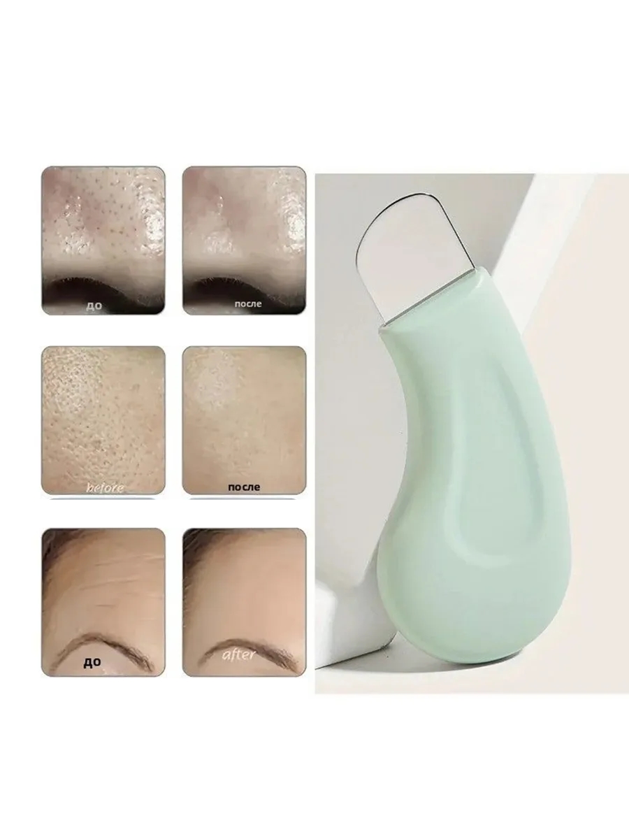 2 li Siyah Nokta ve Akne Temizleyici Cilt Bakım Gözenek Sıkılaştırıcı Spatula 722913